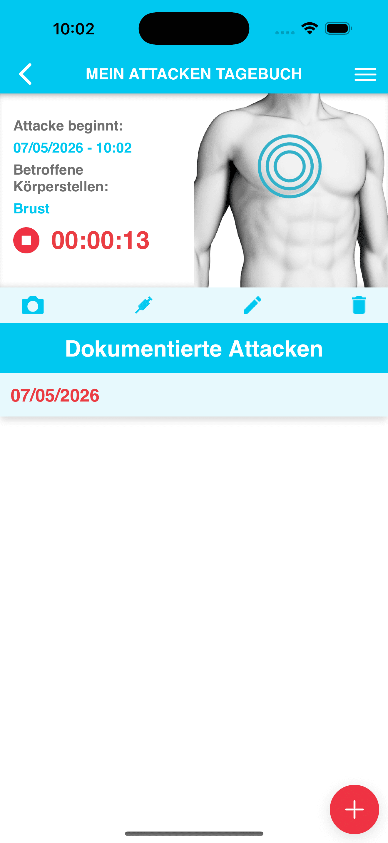 Anonymisierte iOS-Attackenliste für HAE-Patientendokumentation