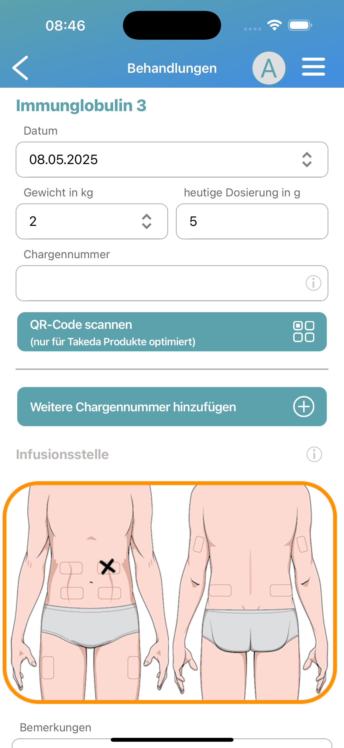 Anonymized iOS treatment entry screen with date weight dosage batch number and infusion-site body selection